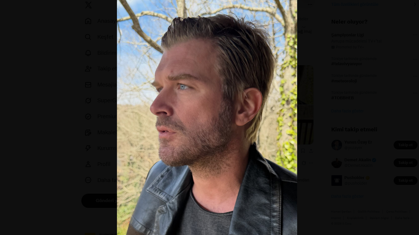 Kıvanç Tatlıtuğ Yeni Imaj (3)