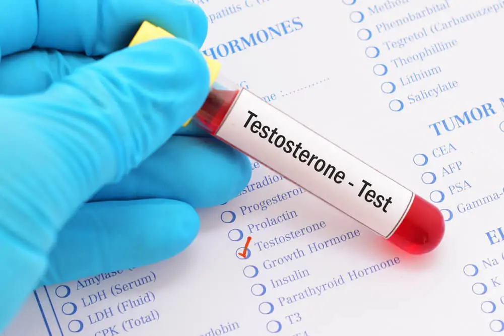 Testosteron Testi