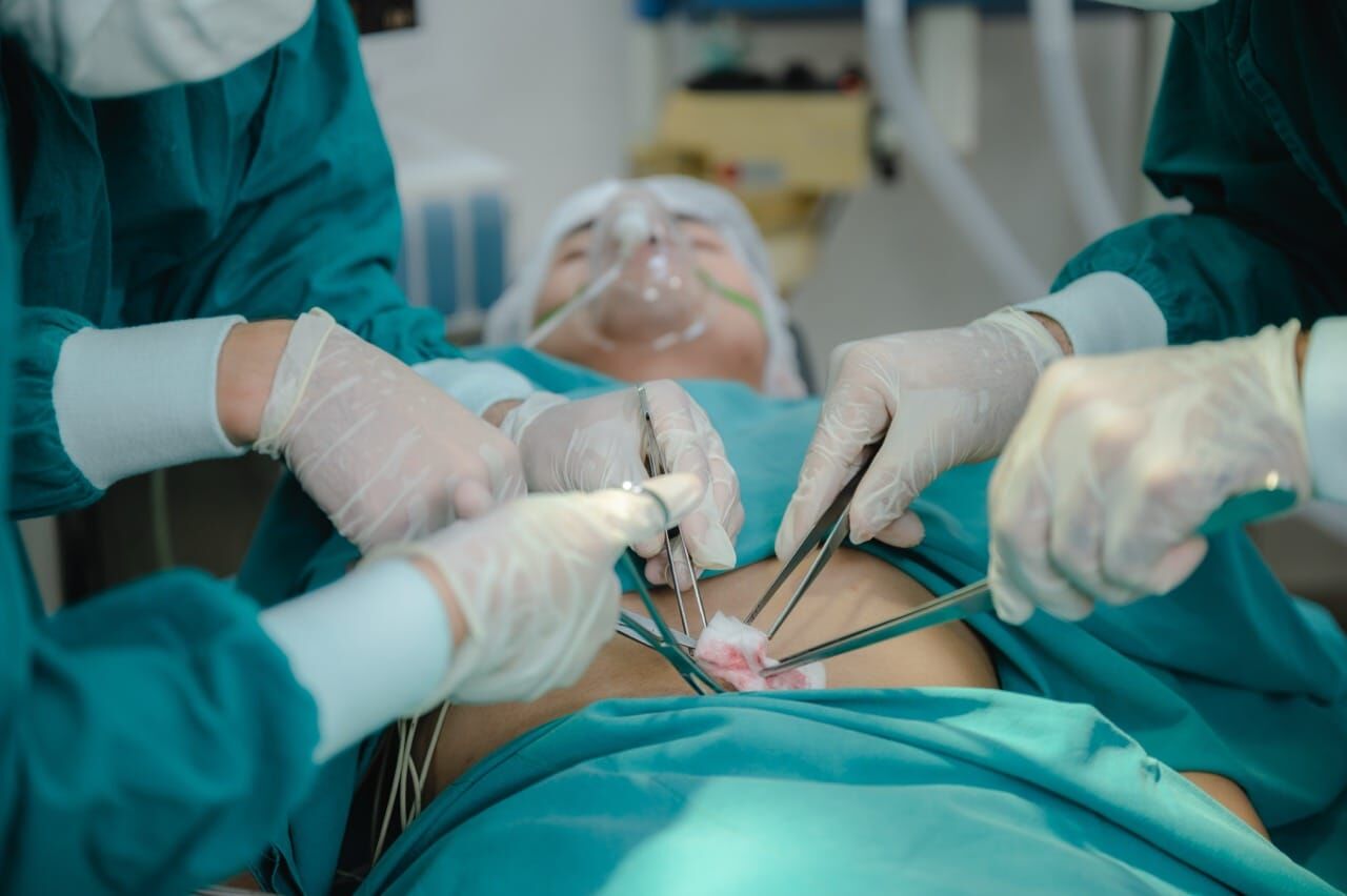 Umbilical Hernia Treatment