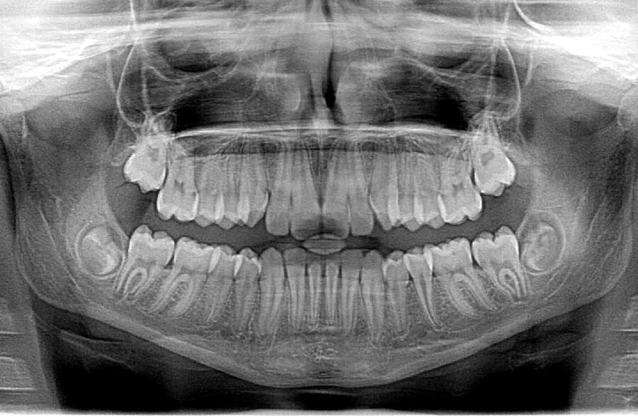 Xray X Ray 2764828 1280 900X588
