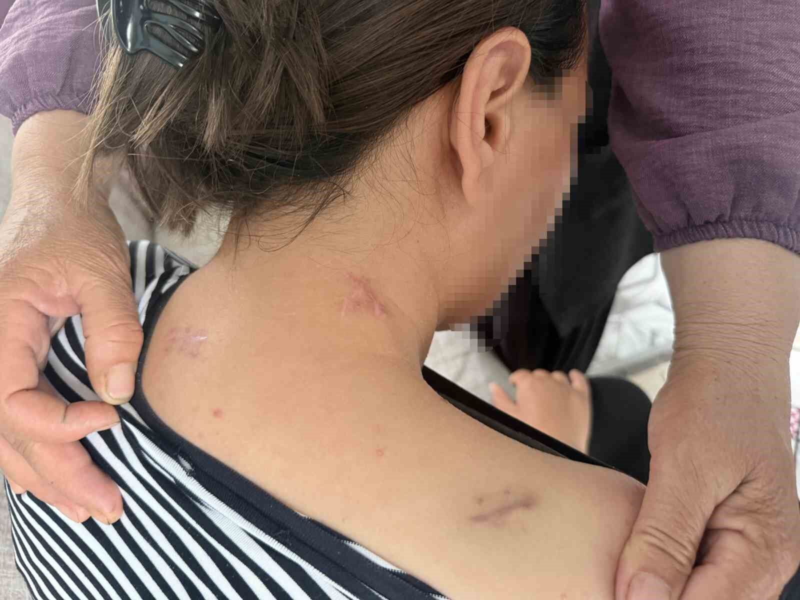 17 Bicak Darbesi Aldi Olu Numarasiyla Kurtuldu Kocasinin En Agir Cezayi Almasini Istedi J I N Cdv5C