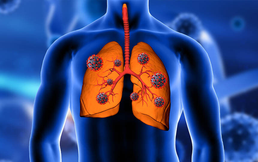 Enfeksiyon Hastaliklari Ve Klinik Mikrobiyoloji 640Eea2928892