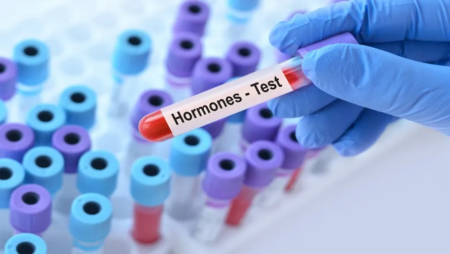 Hormon Testi Nedir Nasil Yapilir