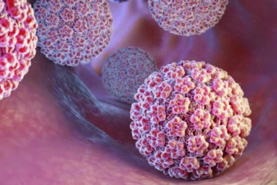 Hpv Human Papilloma Virus Resim 926086 W900 H600-1