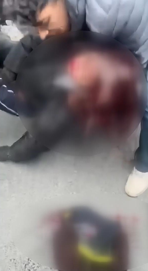 Kagithane De Akilalmaz Kaza Ehliyetsiz Surucu Yayaya Carpti Kiz Arkadasini Alip Kacti 3 1776231764