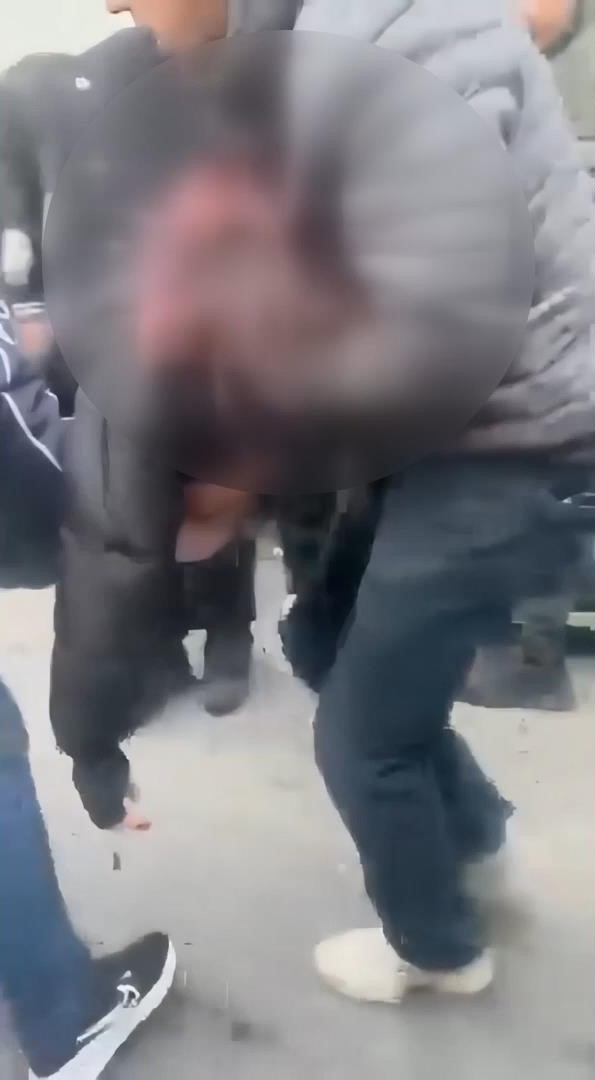 Kagithane De Akilalmaz Kaza Ehliyetsiz Surucu Yayaya Carpti Kiz Arkadasini Alip Kacti 4 1776231764