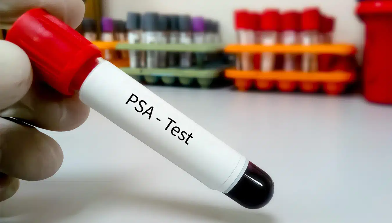 Psa Nedir 15