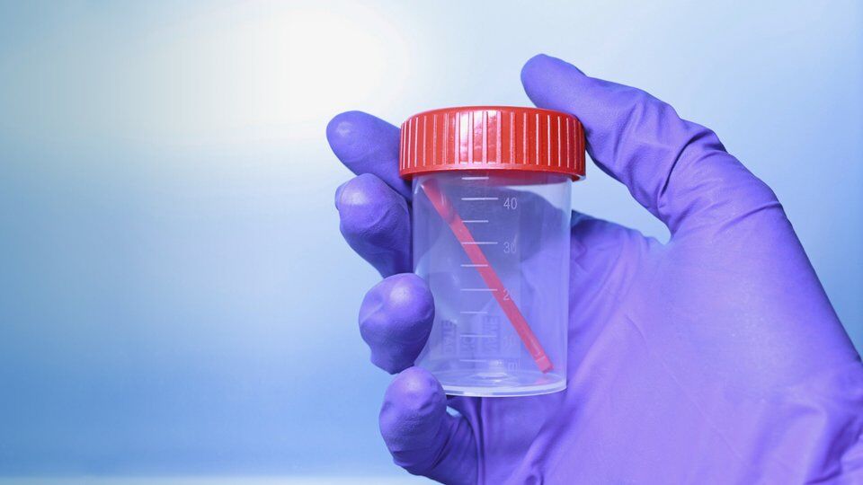 Stool Test Buyuk Anadolu Hastanesi-1
