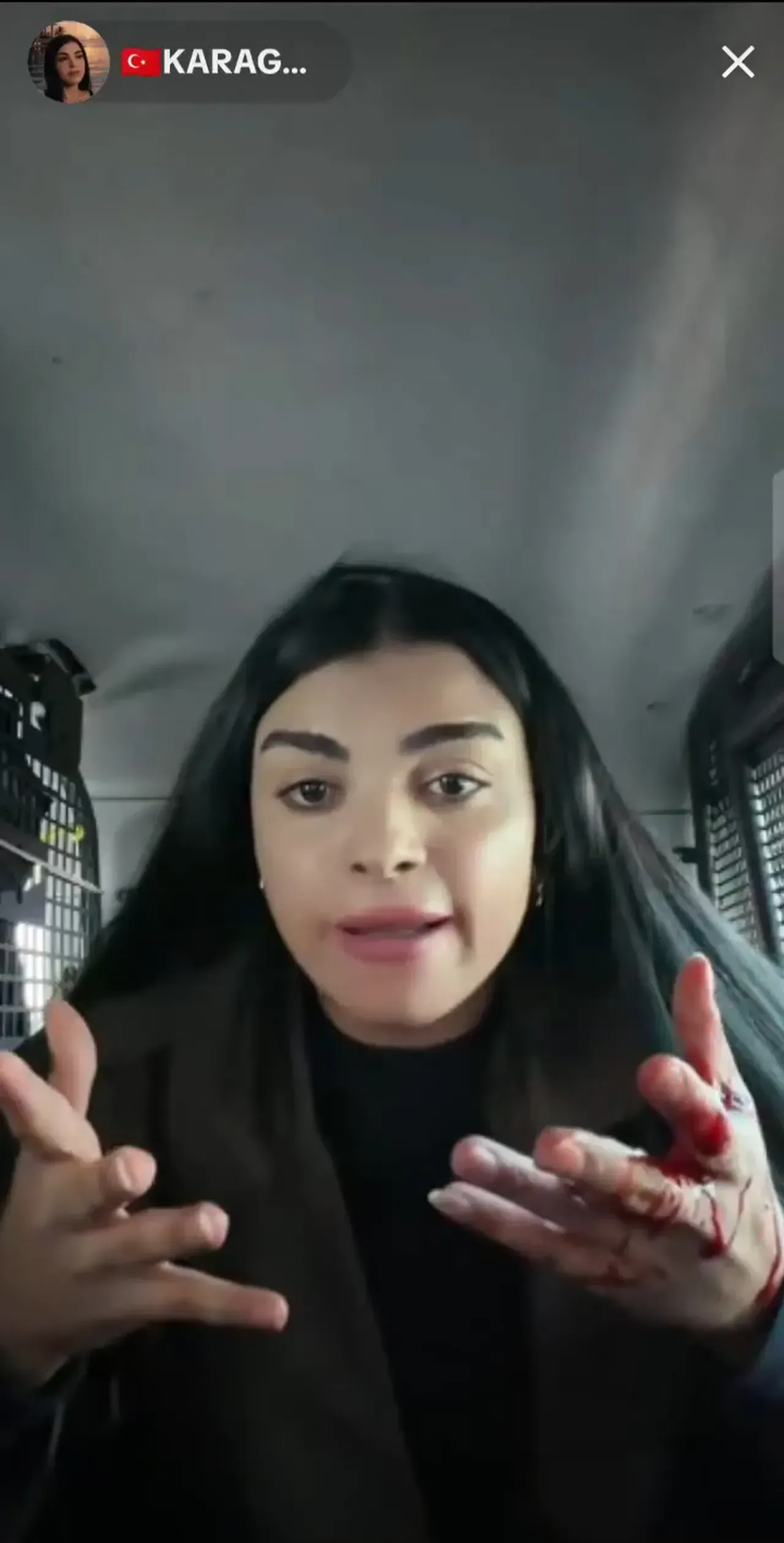 Tiktokta Kanli Yayin Fenomen Karagul Sokak Ortasinda Bir Kadini Bicakladi 1785181 202604192217 20260419221738 2