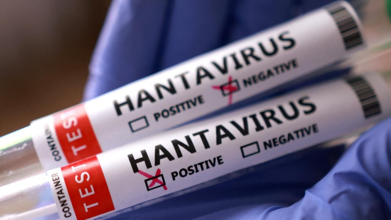 Hantavirus-2