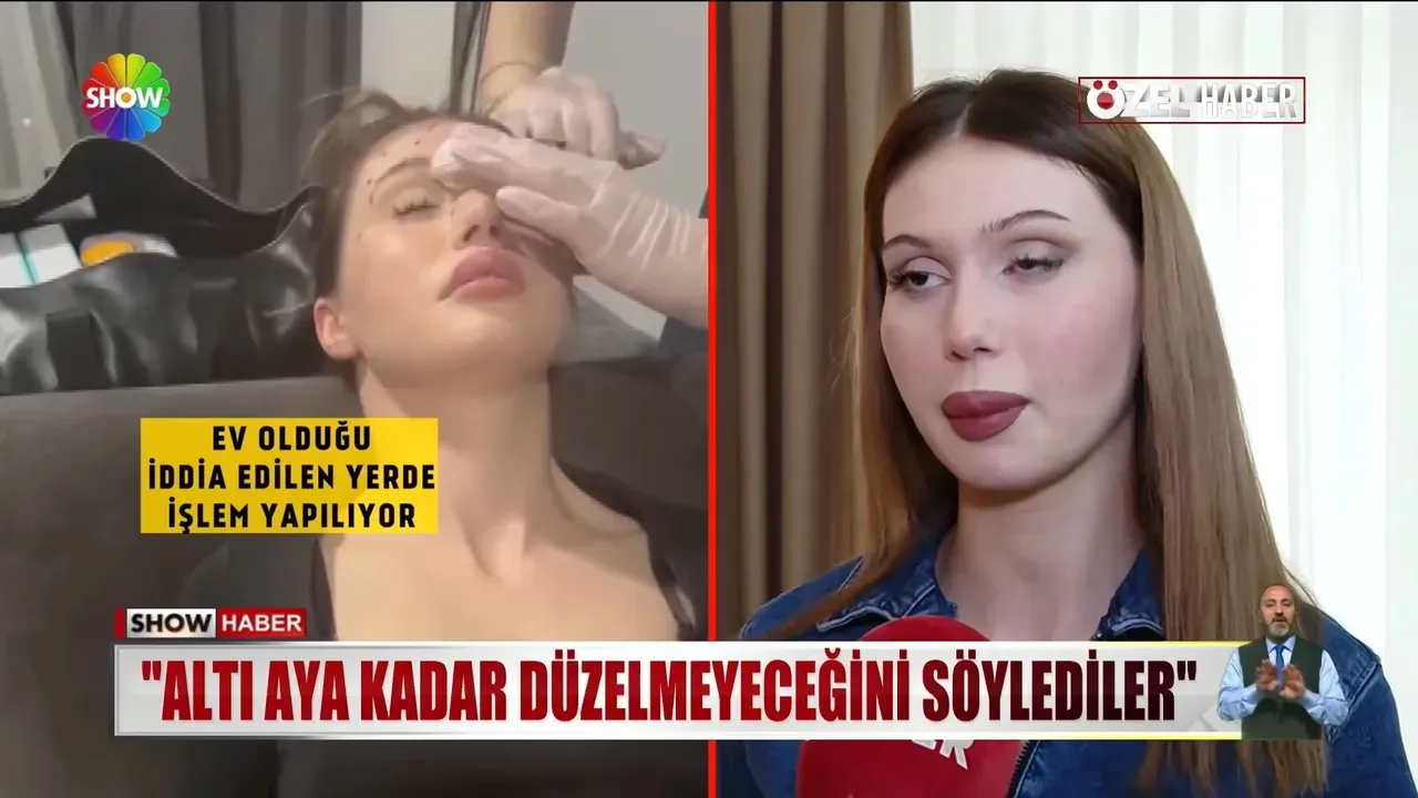 Guzellesmek Isterken Kabusu Yasadi Sahte Doktor Kurbani Gelin Adayinin Goz Kapagi Dus 1793991 202605312223 20260531222346 3