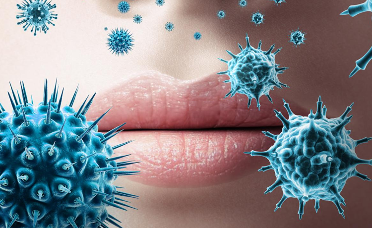 Herpes-1