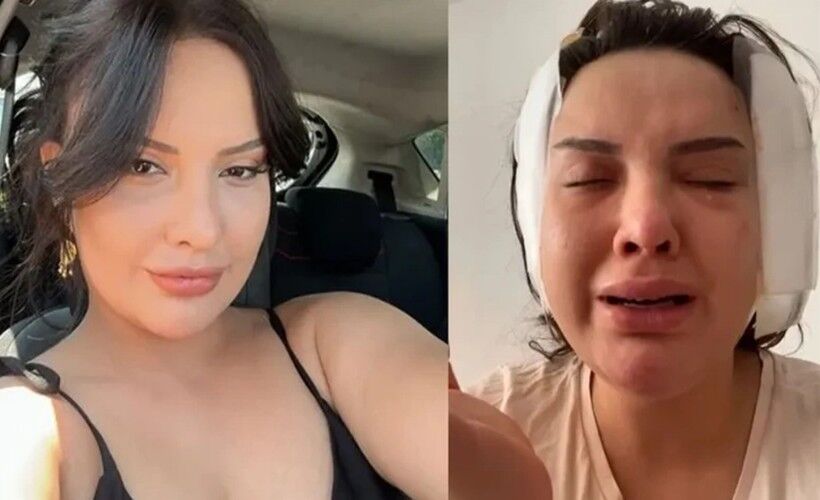 Izmir De Estetik Operasyon Faciasi Magdur Kadin Adalet Ariyor 313578 News Big