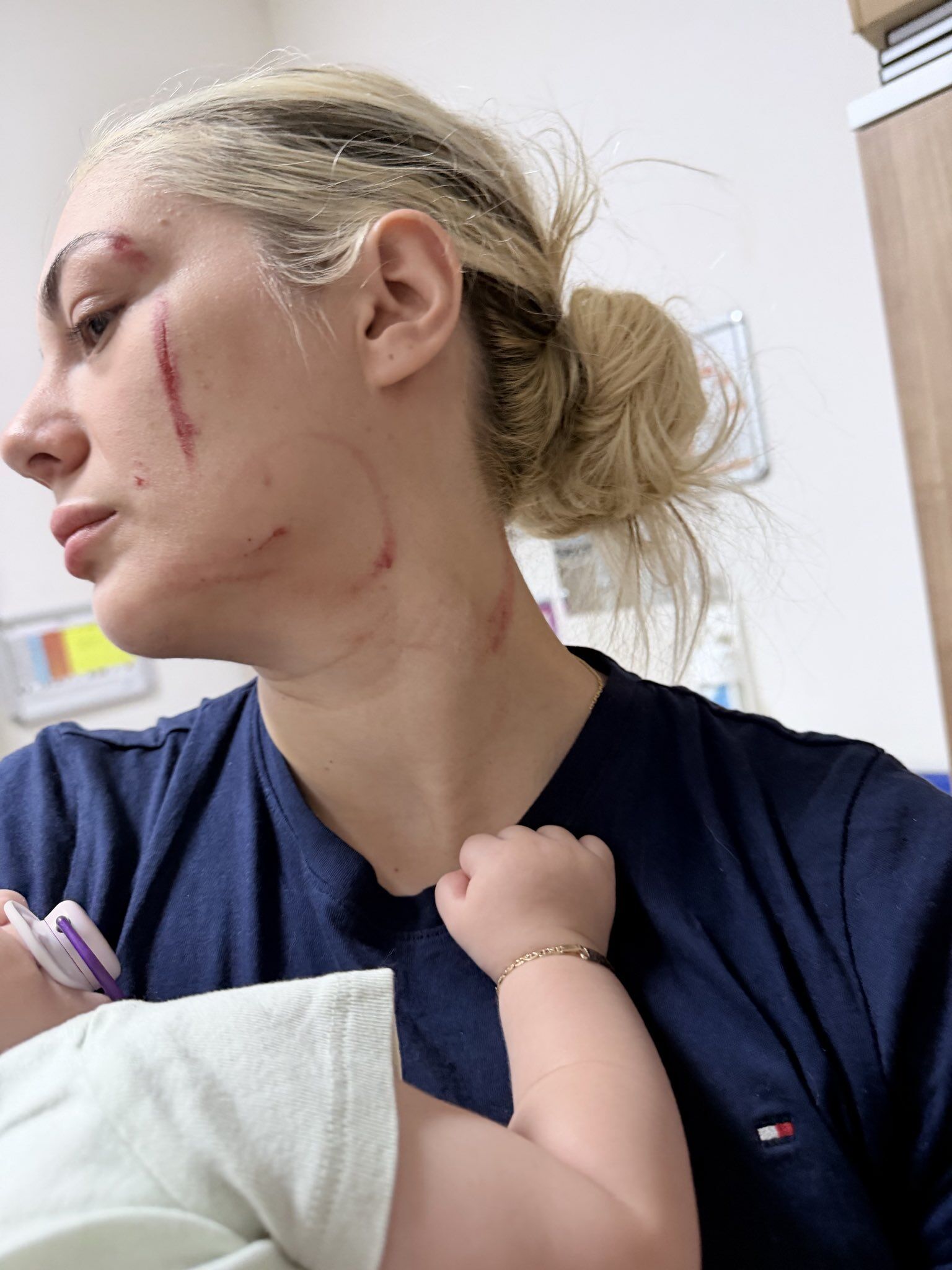 2,5 yıldır şiddet gören Derin Deniz’in son hali ortaya çıktı