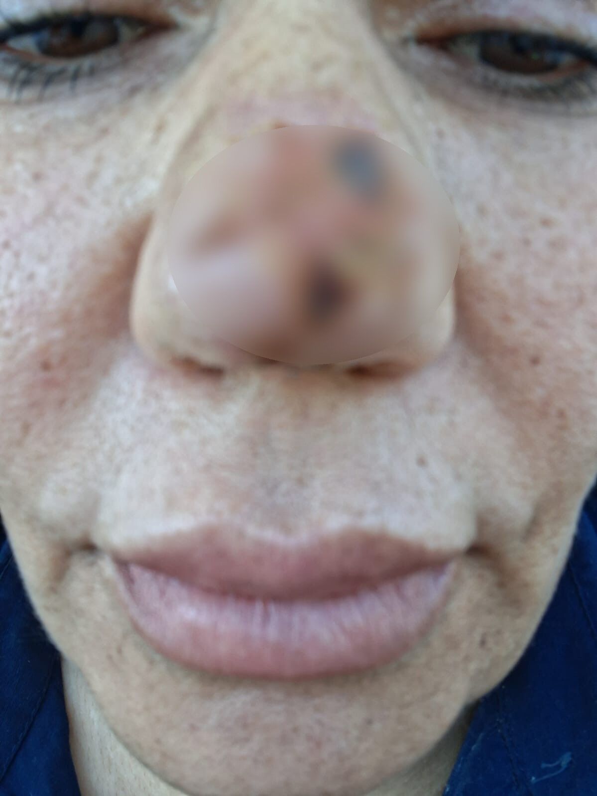 A W770384 04