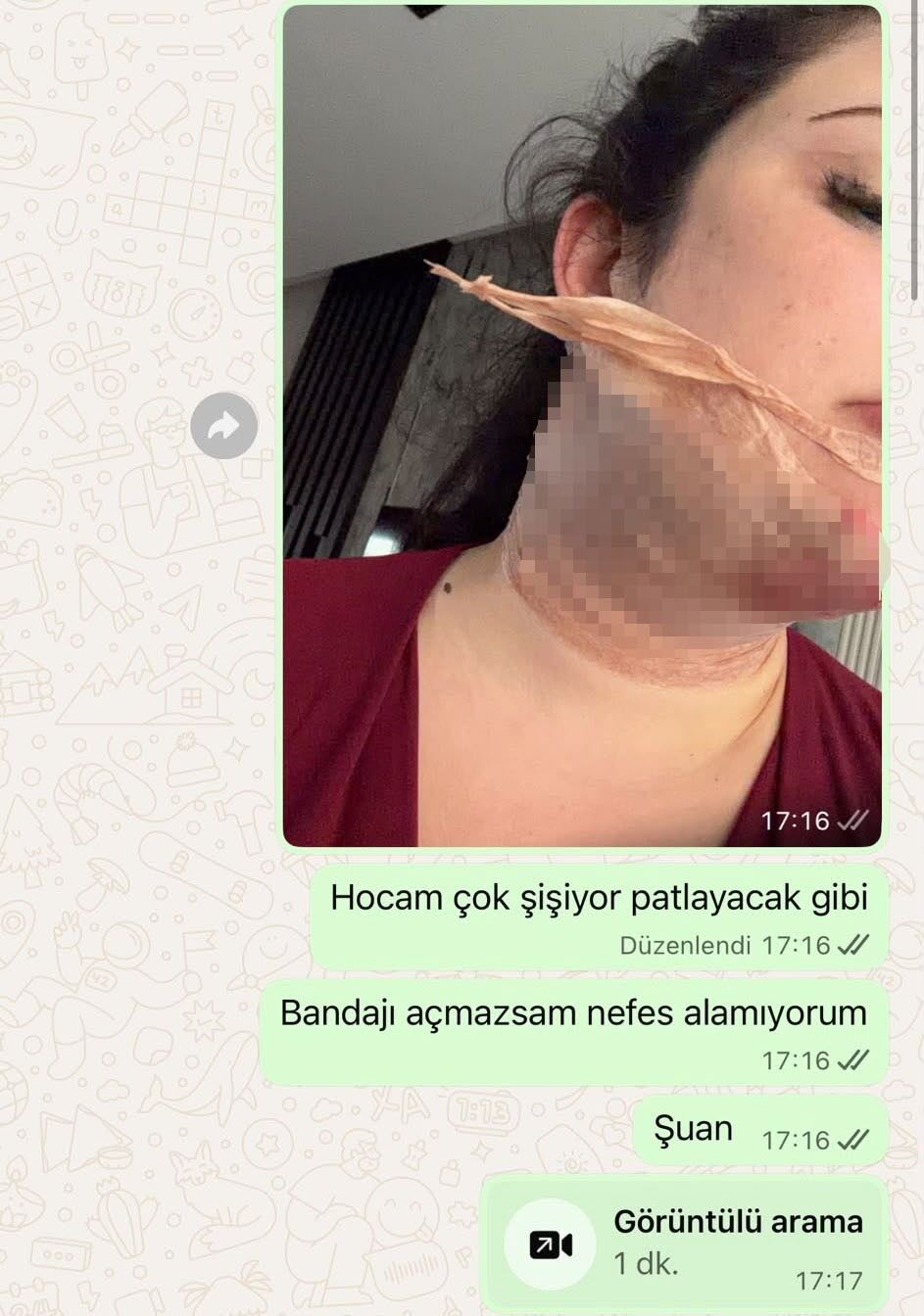 A W782234 11