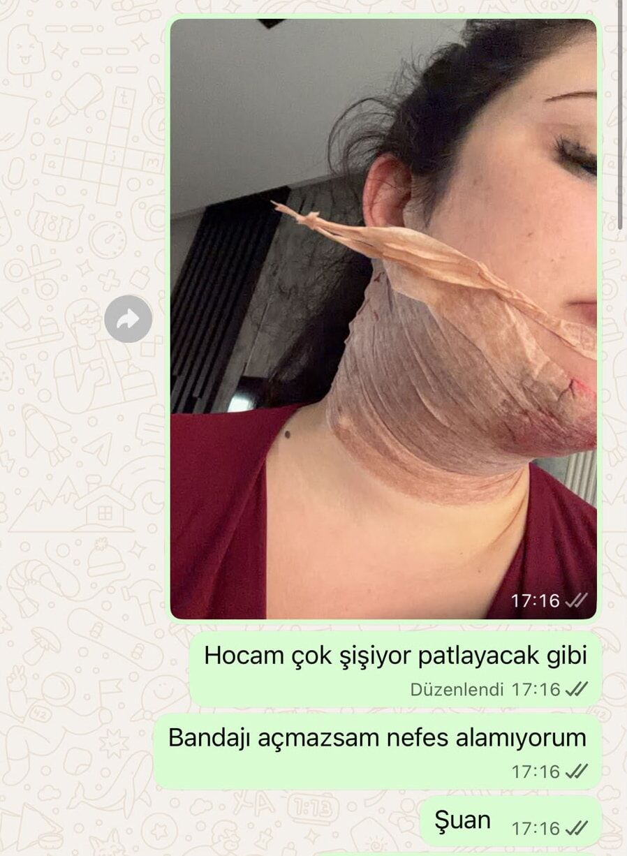 Estetik 2