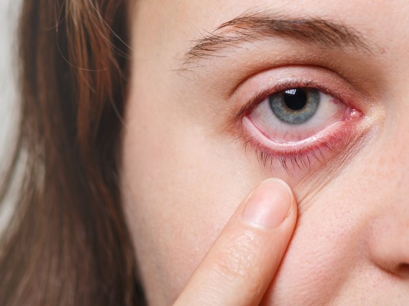 Retina Yirtilmasi