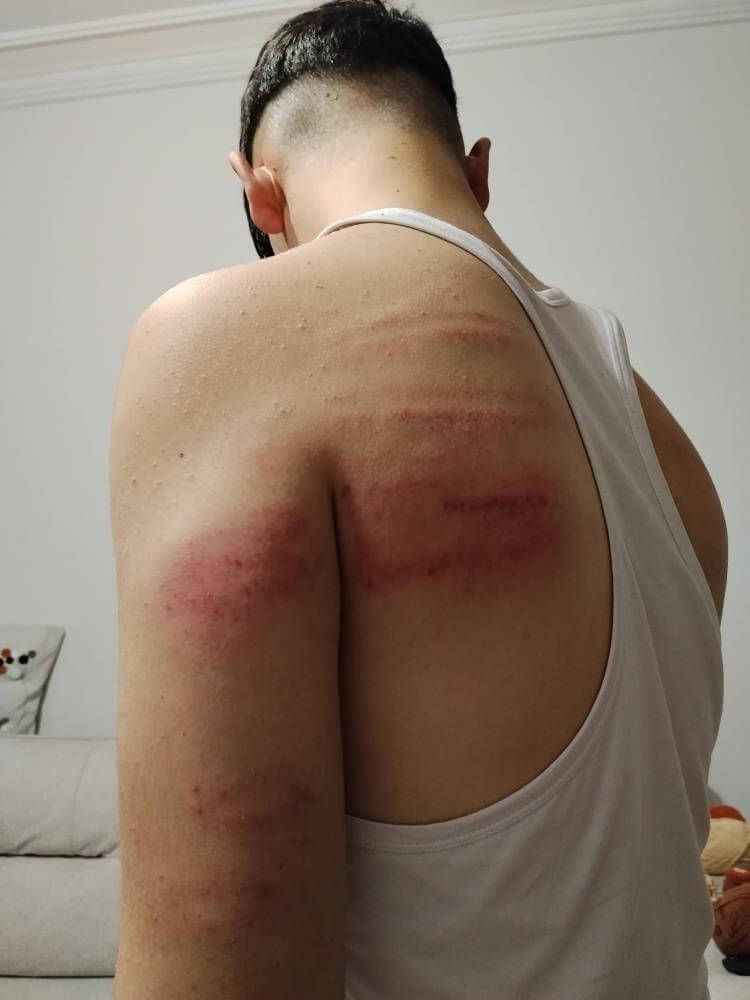 15 Yaşındaki Berber Çırağına Darp Iddiası