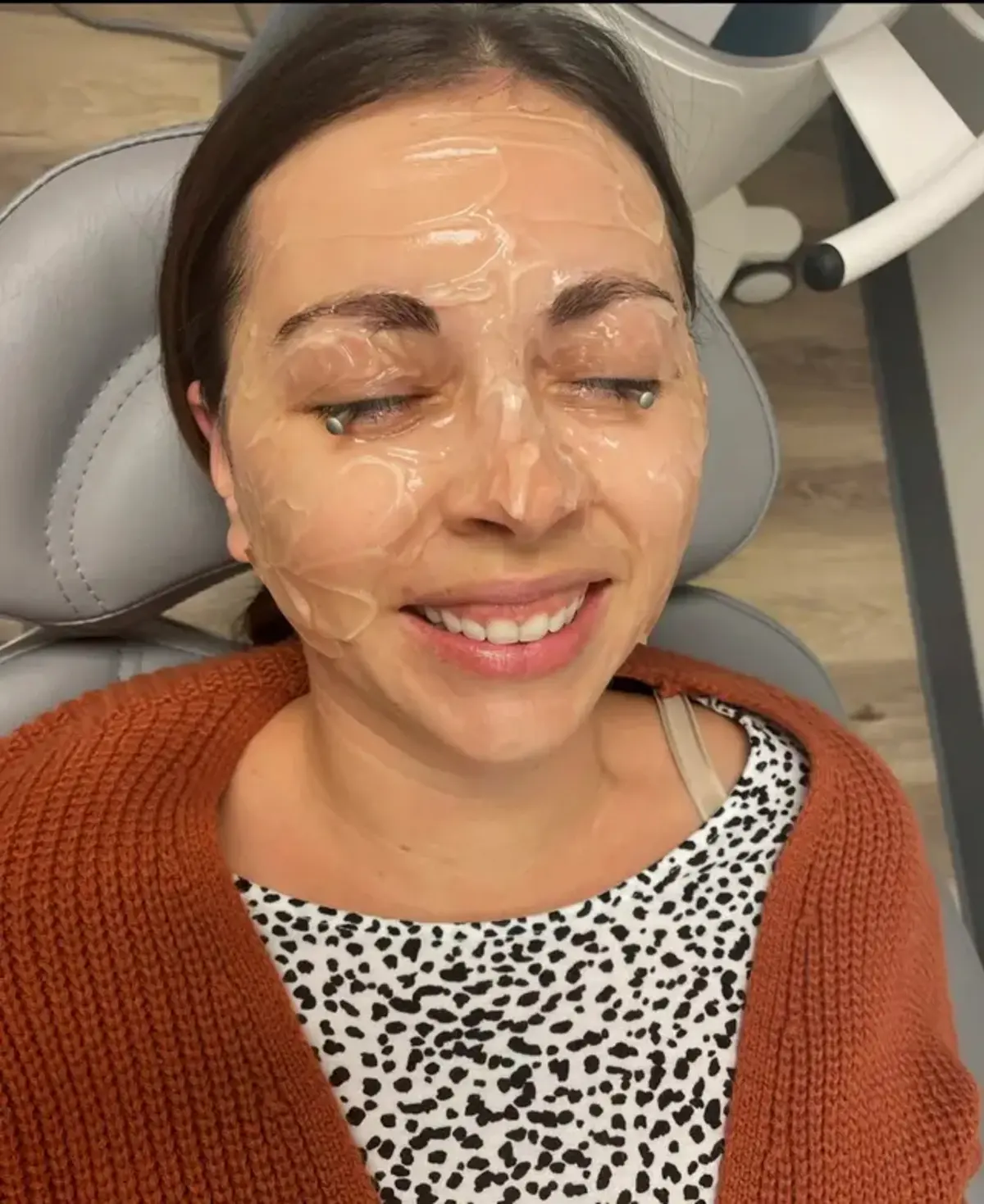 20 Yıl Makyajla Uyudu Göz Kapağı Göz Küresine Yapıştııı
