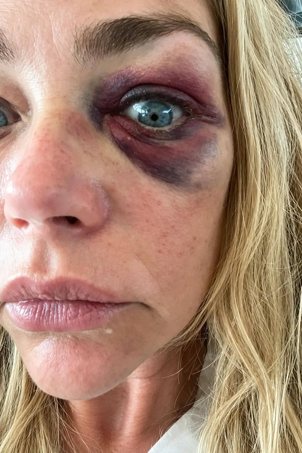 Denise Richards Iki Boşanmanın Ardından Evliliğe Kapıyı Kapattı (2)