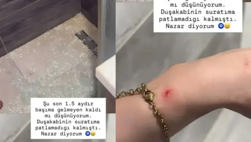 Nefise Karatay’ın Yüzüne Duşakabin Camı Patladı, Korku Dolu Anlar Yaşadıı