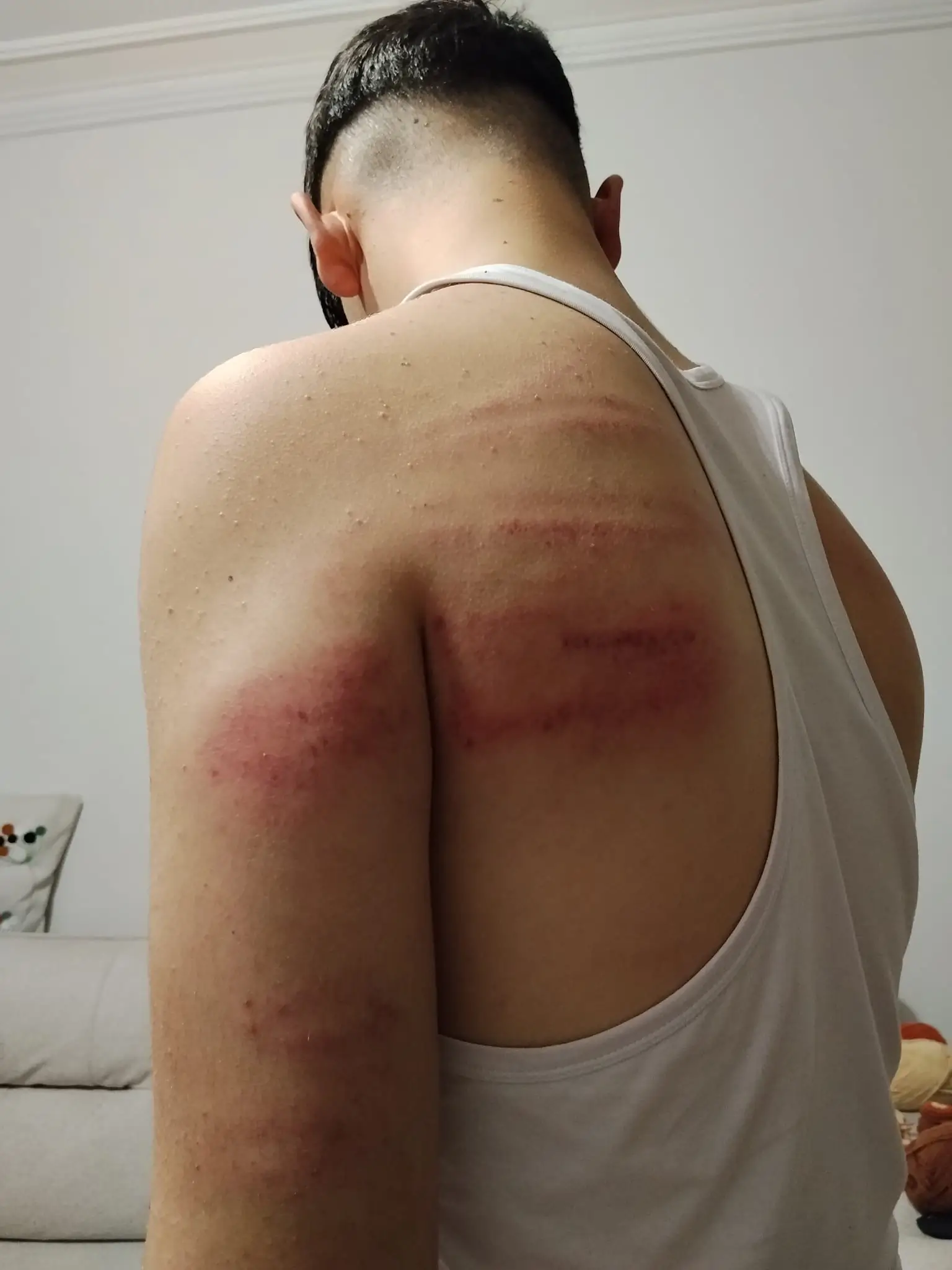 Niğde'de 15 Yaşındaki Çırağa Darp Iddiası Önce Dövdü, Sonra Temizlik Yaptırdı (2)