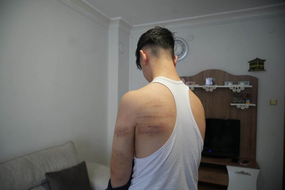Önce Dövdü, Sonra Temizlik Yaptırdı