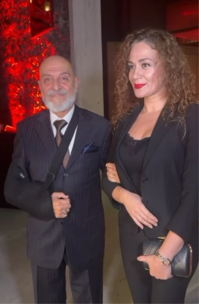 Özge Borak’ın Babası Merdivenlerden Düştü, Kolu Alçıya Alındıı